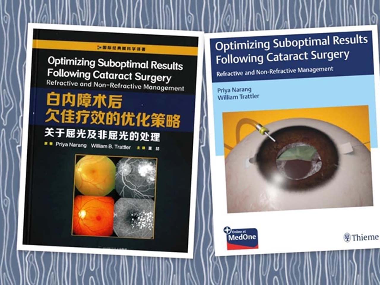 Retina Specialist Ahmedabad  
